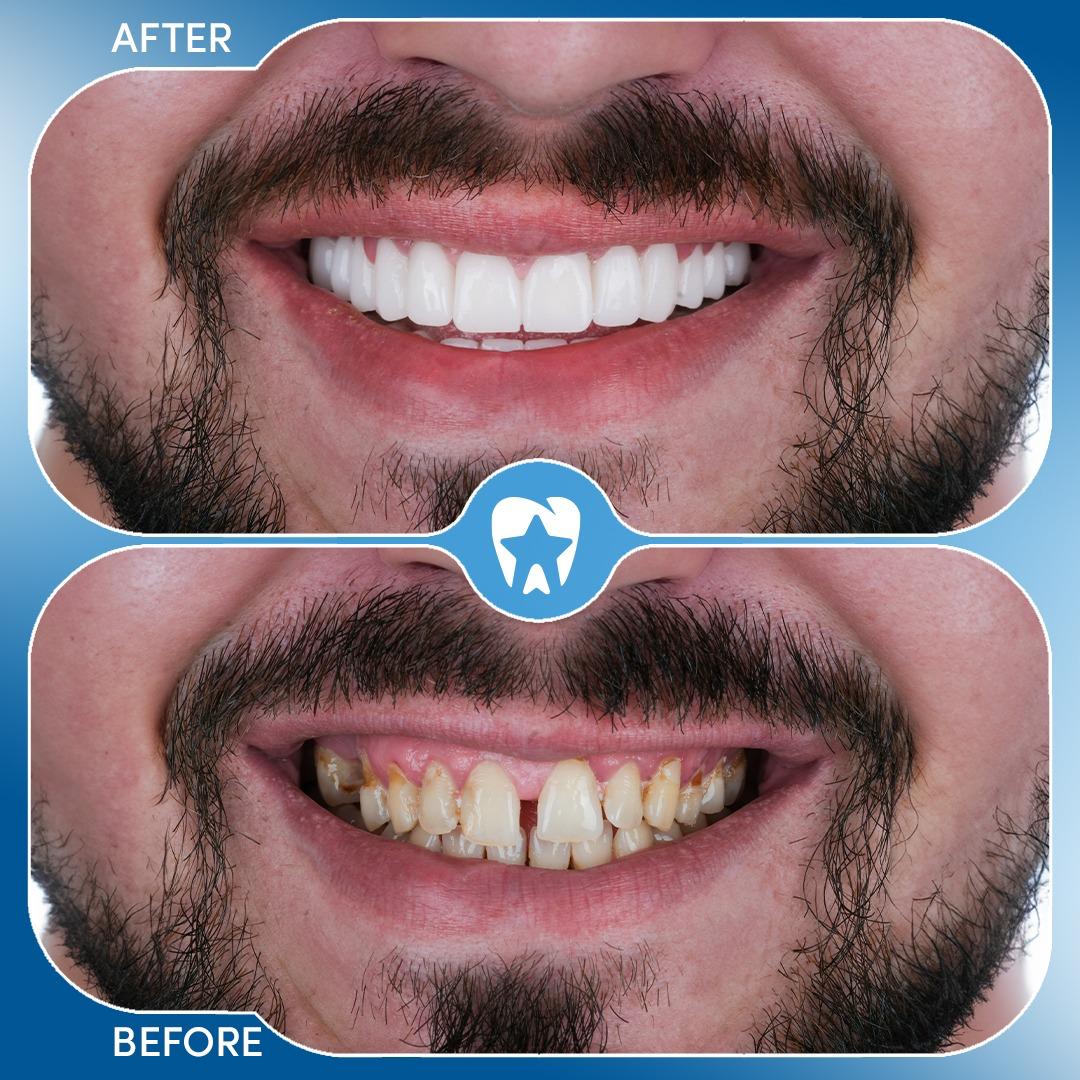 Before and after dental treatment