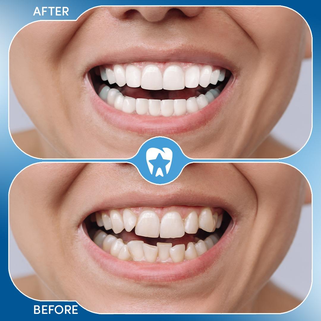 Before and after dental treatment